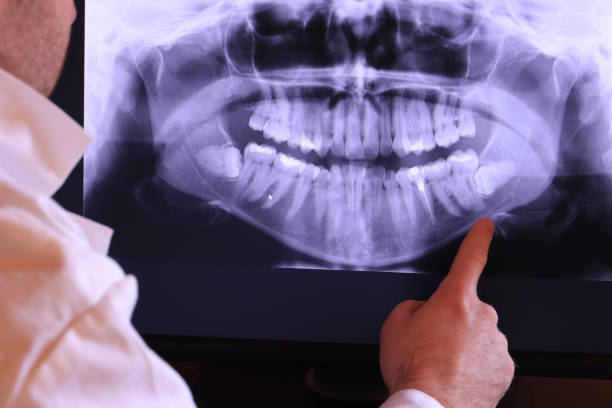 Best After-Hours Emergency Dentist in Charlotte Park, FL