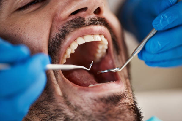 Best Walk-In Emergency Dentist in Charlotte Park, FL