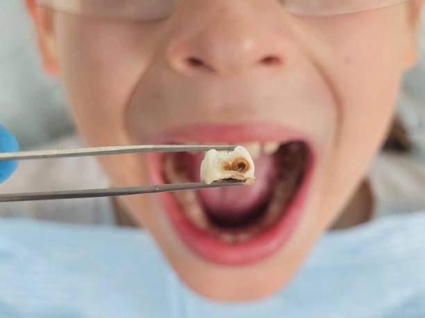 Best 24-Hour Emergency Dentist in Charlotte Park, FL